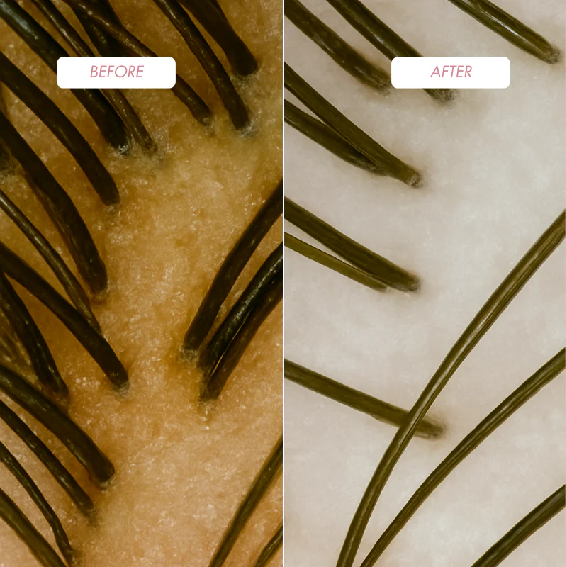 ProHair Reset & Repair – Trychologiczny rytuał oczyszczająco-regenerujący (Peeling + Maska) - Image 10